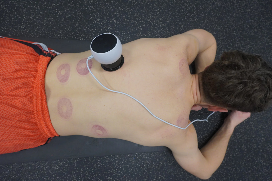 Smart Cupping Massager - EZ RECOVERY